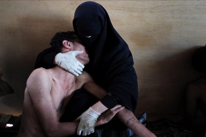 Aranda ha sido proclamado hoy, 10 de febrero de 2012 vencedor del World Press Photo, el más importante certamen mundial de fotoperiodismo, por la imagen de un herido en las revueltas de Yemen que es abrazado por una mujer con velo.