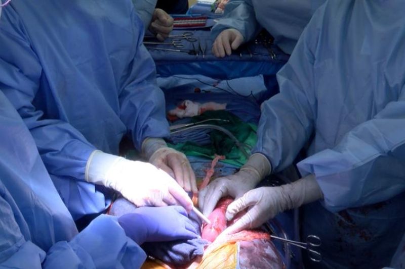 Un equipo de investigadores estadounidenses ha logrado trasplantar con éxito dos riñones de cerdo modificados genéticamente a un humano que se encontraba en muerte cerebral. Fotos cedidas por la Universidad de Alabama (EEUU). Jeff Myers, UAB.