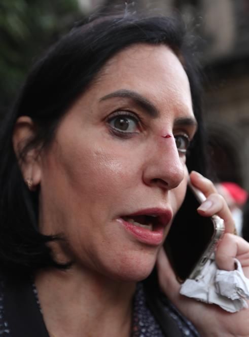 La alcaldesa electa de Álvaro Obregón, Lía Limón, habla hoy por teléfono tras ser agredida por la policía durante una manifestación en los alrededores del Congreso local de la capital, en Ciudad de México (México).